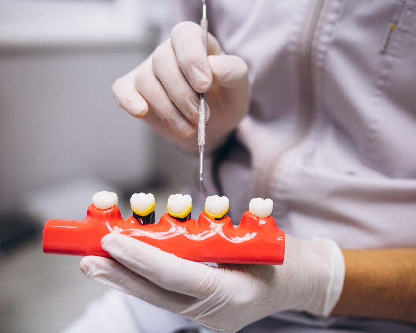 人工植牙-蒔雨牙醫診所