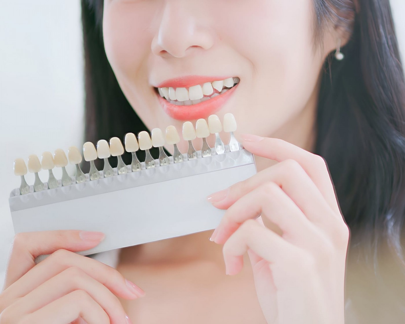 美容牙科-蒔雨牙醫診所