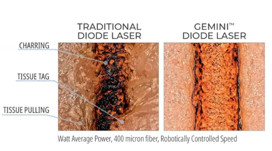 大範圍的齒質缺損-蒔雨牙醫診所